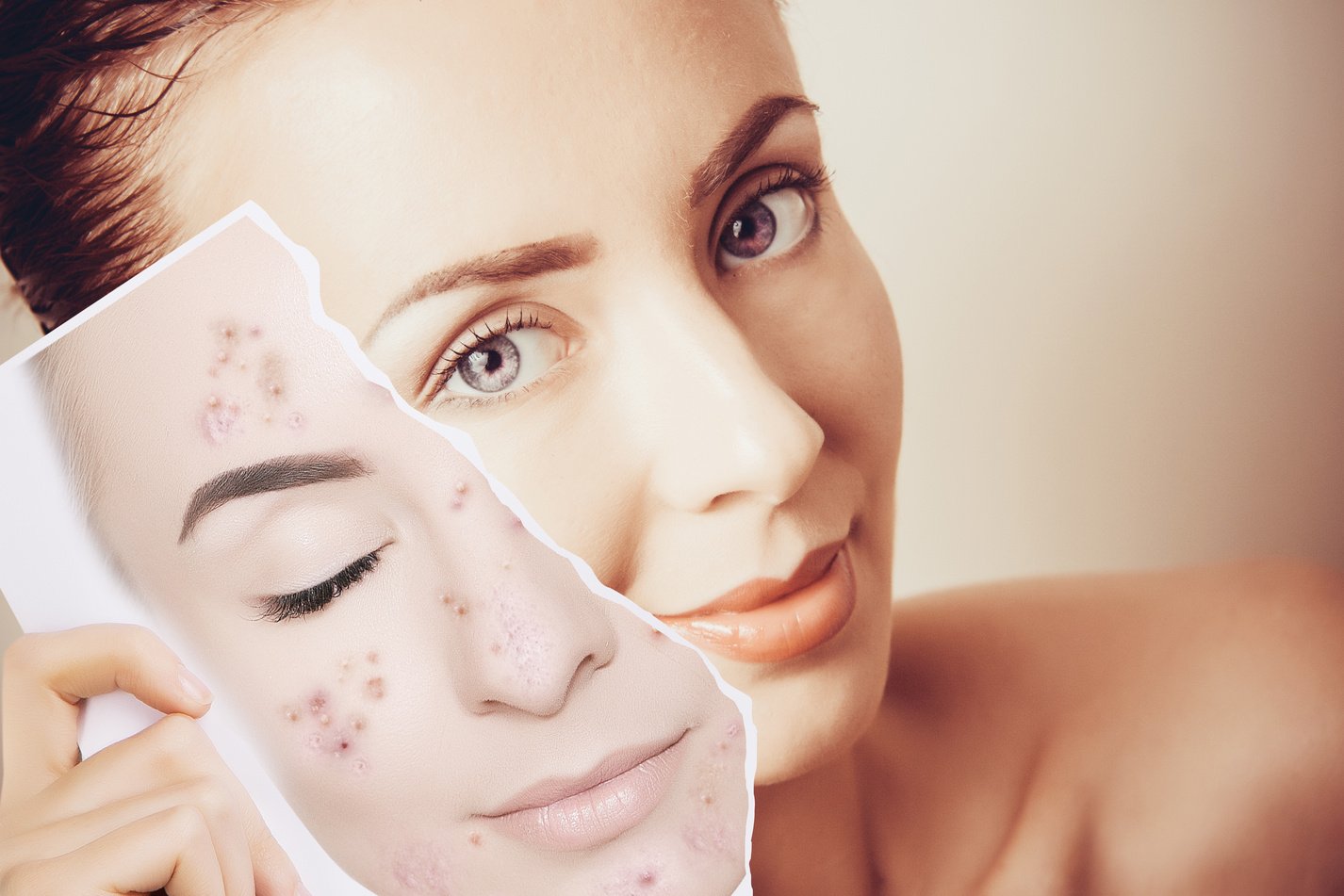 young woman face portrait with photo of her spotted skin